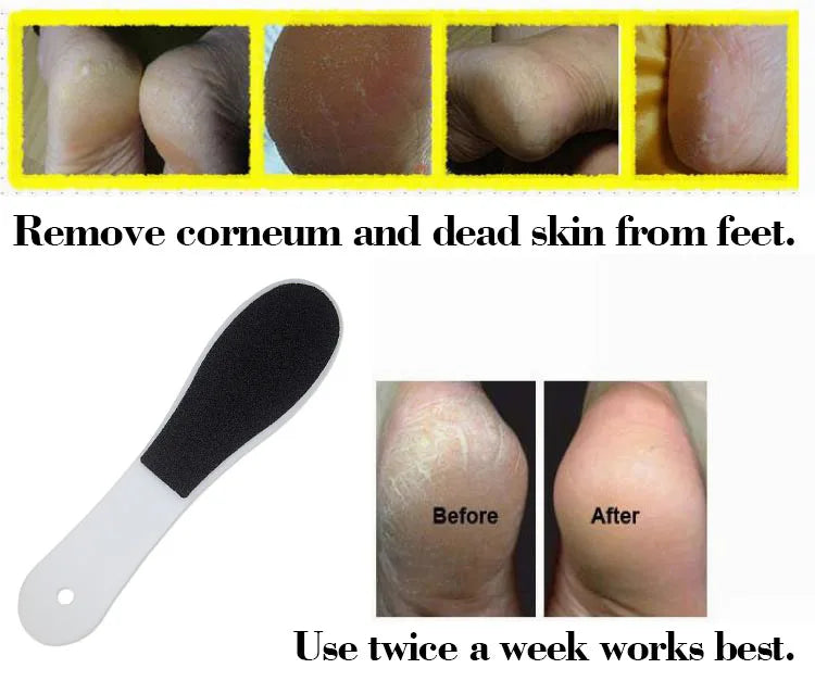 Kimcci Two Sided Pedicure Foot File Pedicure Foot Rasp Pumice Stone for Foot Care Grinding for the Feet Lima para Pies - Glowing Love