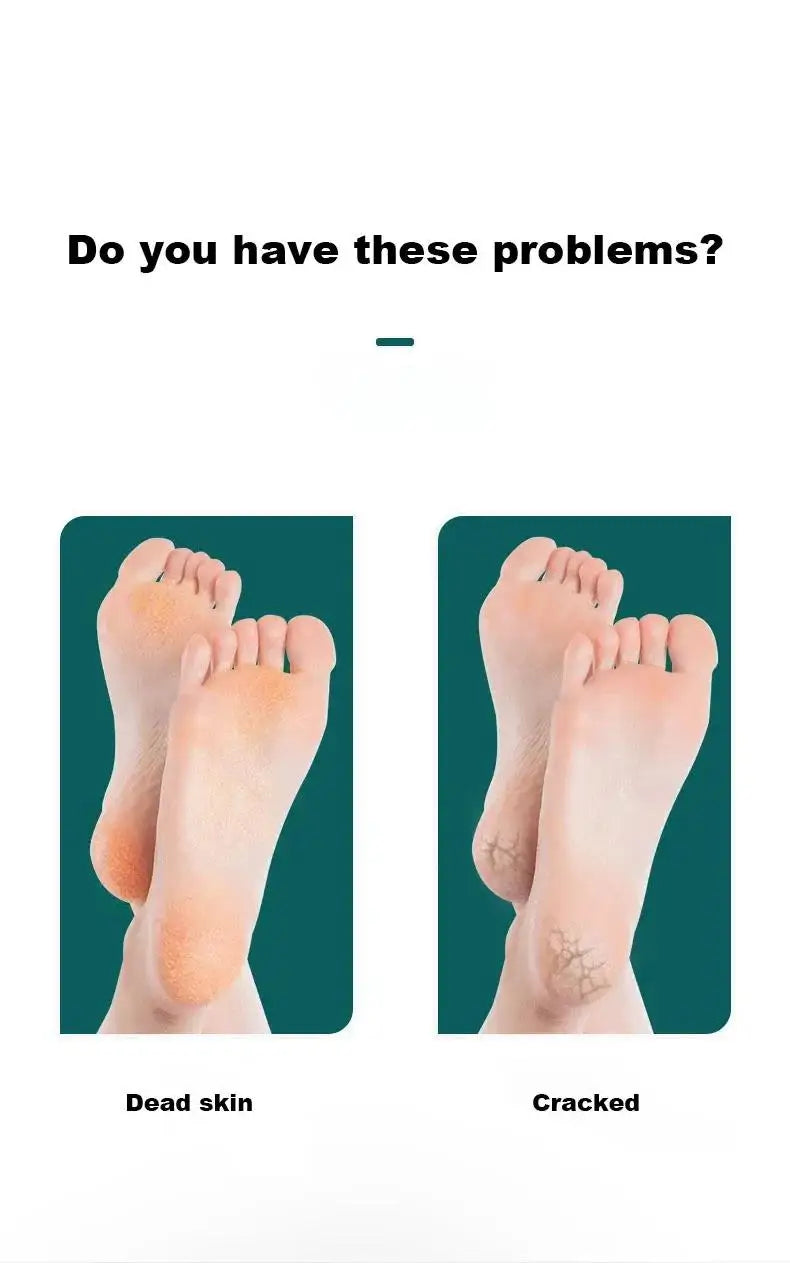 Double Sided Foot File Pedicure Foot Care Tools Dead Skin Callus Remover Stainless Steel Professional - Glowing Love