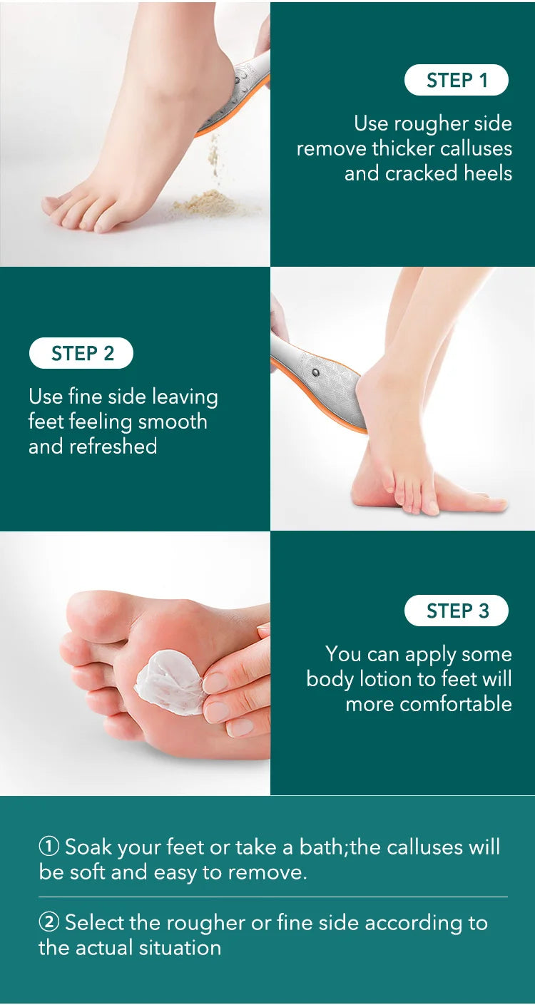 MR.GREEN Double Sided Foot File Pedicure Foot Care Tools Dead Skin Callus Remover Stainless Steel Professional - Glowing Love