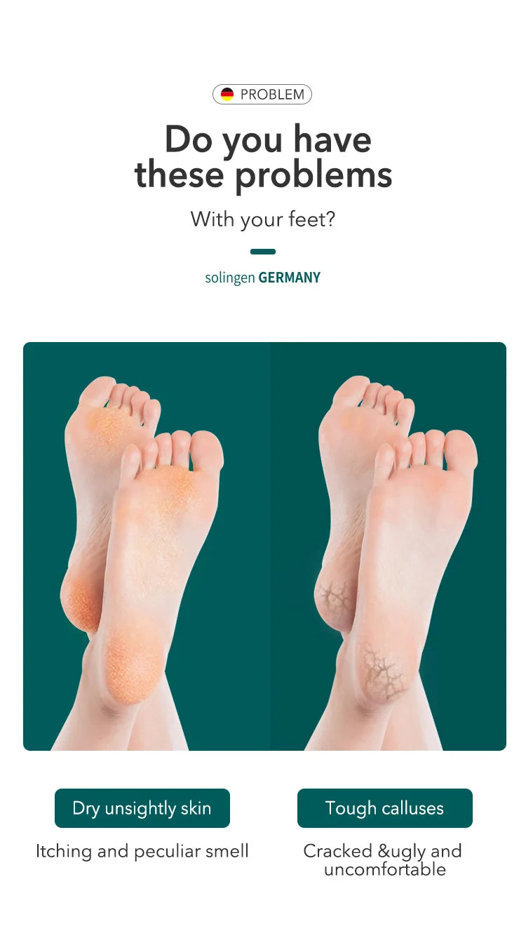 MR.GREEN Double Sided Foot File Pedicure Foot Care Tools Dead Skin Callus Remover Stainless Steel Professional