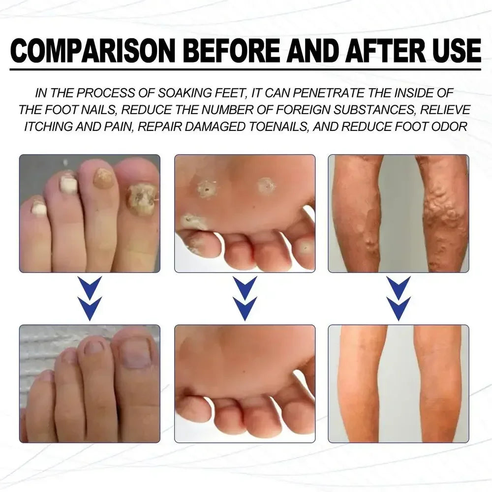 Foot Soaking Salts Pedicure Foot Softening Soak Pedicure Foot Soak Foots 10pcs Organic Foot Softening Capsule Shape Up Care - Glowing Love