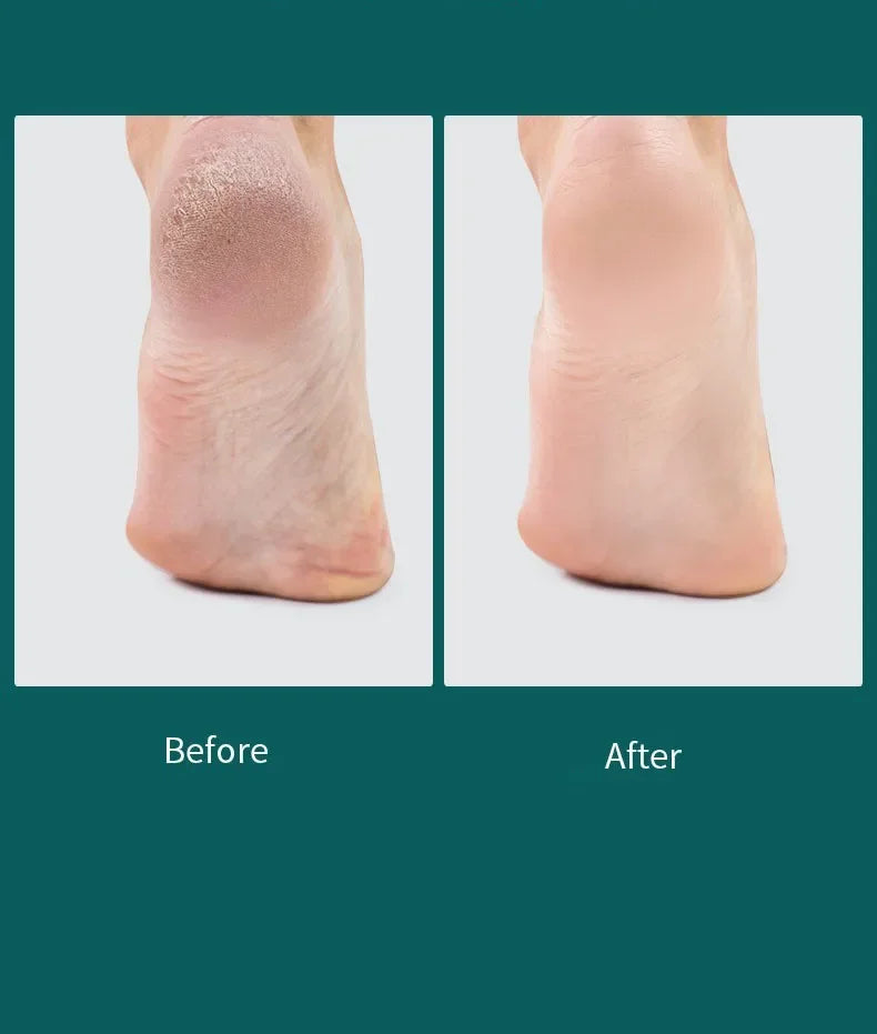 Double Sided Foot File Pedicure Foot Care Tools Dead Skin Callus Remover Stainless Steel Professional - Glowing Love