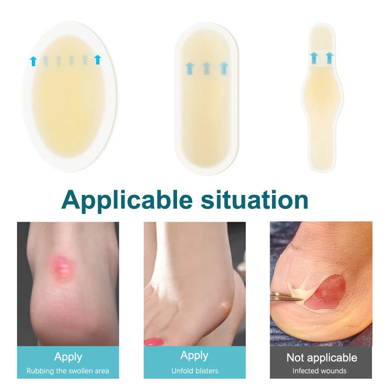 24pcs Adhesive Hydrocolloid Gel Blister Plaster Heel Anti Wear Sticker For Pedicure Foot Care Patch Tool - Glowing Love
